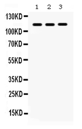 Anti-CARD12 antibody used in Western Blot (WB). GTX04516