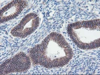 Anti-ALOX15 antibody [OTI3G8] used in IHC (Paraffin sections) (IHC-P). GTX04520