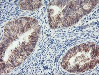 Anti-ALOX15 antibody [OTI3G8] used in IHC (Paraffin sections) (IHC-P). GTX04520