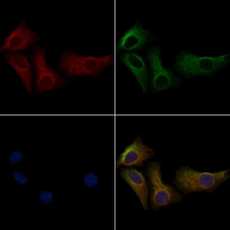Anti-PERK (phospho Thr982) antibody used in Immunocytochemistry/ Immunofluorescence (ICC/IF). GTX04533