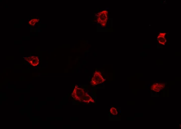 Anti-PERK (phospho Thr982) antibody used in Immunocytochemistry/ Immunofluorescence (ICC/IF). GTX04533