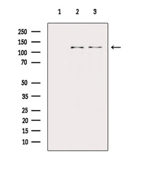 Anti-PERK (phospho Thr982) antibody used in Western Blot (WB). GTX04533