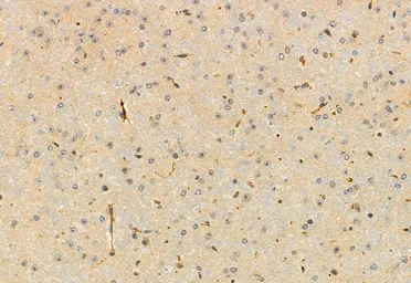 Anti-FAM38A antibody used in IHC (Paraffin sections) (IHC-P). GTX04534