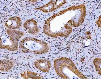 Anti-GLIS1 antibody used in IHC (Paraffin sections) (IHC-P). GTX04548