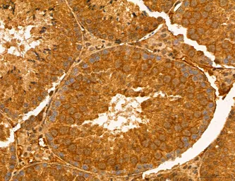 Anti-TIP47 antibody used in IHC (Paraffin sections) (IHC-P). GTX04559