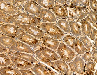 Anti-TIP47 antibody used in IHC (Paraffin sections) (IHC-P). GTX04559