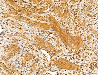Anti-TIP47 antibody used in IHC (Paraffin sections) (IHC-P). GTX04559