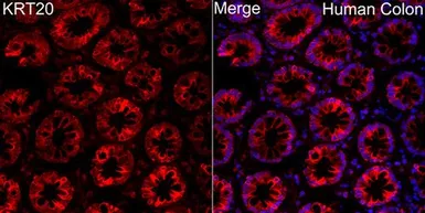 Anti-Cytokeratin 20 antibody used in IHC (Paraffin sections) (IHC-P). GTX04562