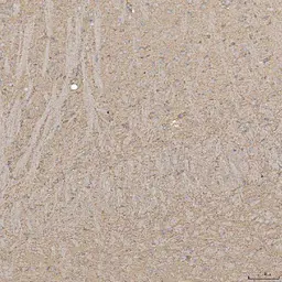 Anti-SLC20A1 antibody used in IHC (Paraffin sections) (IHC-P). GTX04583