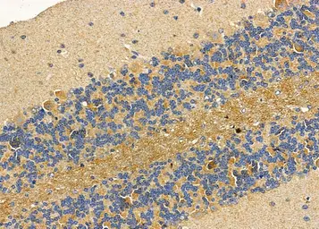 Anti-ASAP1 antibody used in IHC (Paraffin sections) (IHC-P). GTX04589