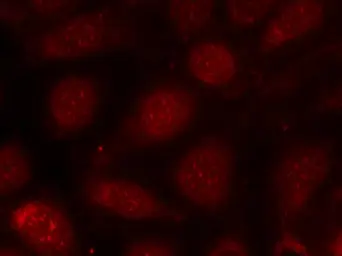 Anti-PKC beta 1 (phospho Thr642) antibody used in Immunocytochemistry/ Immunofluorescence (ICC/IF). GTX04595
