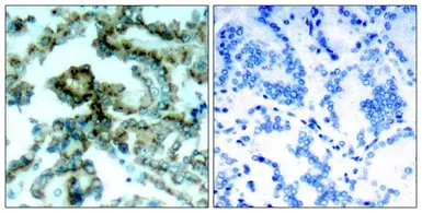 Anti-PKC beta 1 (phospho Thr642) antibody used in IHC (Paraffin sections) (IHC-P). GTX04595