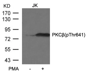 Anti-PKC beta 1 (phospho Thr642) antibody used in Western Blot (WB). GTX04595