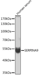 Anti-GCET1 antibody used in Western Blot (WB). GTX04609