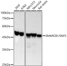 Anti-SNF5 antibody [ARC53139] used in Western Blot (WB). GTX04623