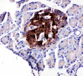 Anti-WISP1 antibody used in IHC (Paraffin sections) (IHC-P). GTX04633