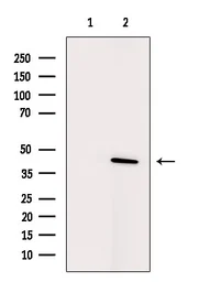 Anti-SCD antibody used in Western Blot (WB). GTX04644