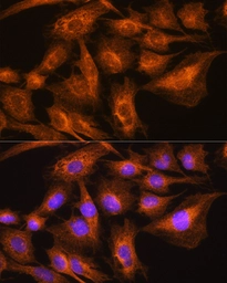 Anti-Apolipoprotein A2 antibody used in Immunocytochemistry/ Immunofluorescence (ICC/IF). GTX04661