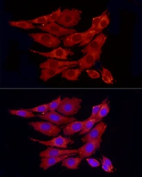 Anti-PPP1A antibody used in Immunocytochemistry/ Immunofluorescence (ICC/IF). GTX04684