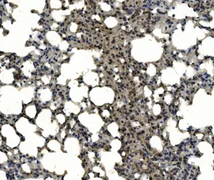 Anti-CD11c antibody used in IHC (Paraffin sections) (IHC-P). GTX04685