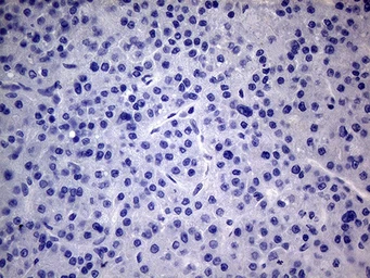 Anti-PMP22 antibody [OTI5D1] used in IHC (Paraffin sections) (IHC-P). GTX04688