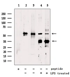 Anti-Gasdermin D antibody used in Western Blot (WB). GTX04690