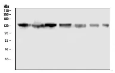 Anti-GM130 antibody [6D4] used in Western Blot (WB). GTX04699