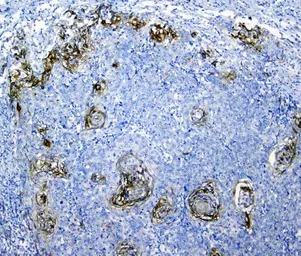 Anti-SLC34A2 antibody used in IHC (Paraffin sections) (IHC-P). GTX04719