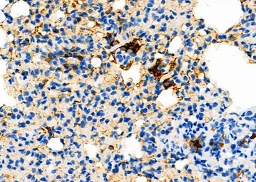 Anti-Calcitonin Receptor antibody used in IHC (Paraffin sections) (IHC-P). GTX04724