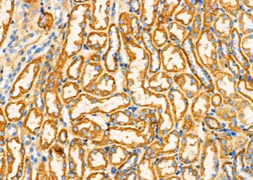 Anti-Calcitonin Receptor antibody used in IHC (Paraffin sections) (IHC-P). GTX04724