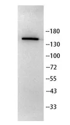 Anti-YSK4 antibody used in Western Blot (WB). GTX04734