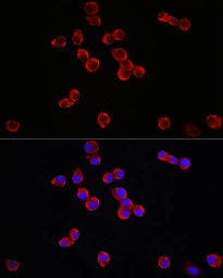 Anti-TrkB antibody used in Immunocytochemistry/ Immunofluorescence (ICC/IF). GTX04764