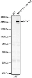 Anti-MYH7 antibody used in Western Blot (WB). GTX04788