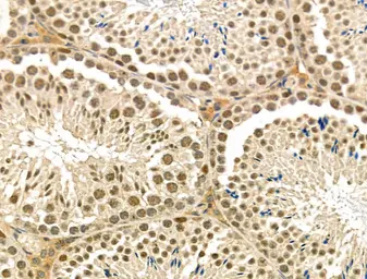 Anti-BRN3A antibody used in IHC (Paraffin sections) (IHC-P). GTX04795