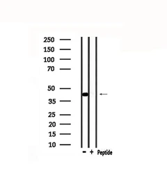 Anti-BRN3A antibody used in Western Blot (WB). GTX04795