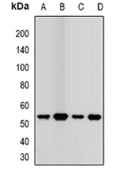 Anti-Transcobalamin 2 antibody used in Western Blot (WB). GTX04826