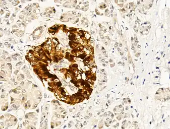 Anti-MMP13 antibody used in IHC (Paraffin sections) (IHC-P). GTX04845