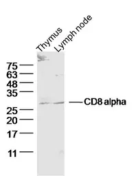 Anti-CD8 alpha antibody used in Western Blot (WB). GTX04862