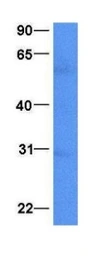Anti-NKX2.8 antibody used in Western Blot (WB). GTX04864