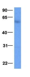 Anti-NKX2.8 antibody used in Western Blot (WB). GTX04864