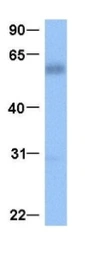 Anti-NKX2.8 antibody used in Western Blot (WB). GTX04864