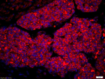 Anti-Amphiregulin antibody used in IHC (Paraffin sections) (IHC-P). GTX04890