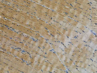 Anti-SMAD1+5+8(9) antibody used in IHC (Paraffin sections) (IHC-P). GTX04895