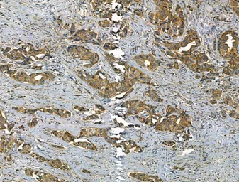 Anti-SMAD1+5+8(9) antibody used in IHC (Paraffin sections) (IHC-P). GTX04895