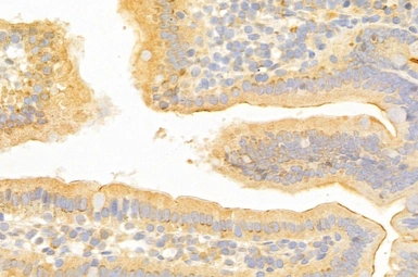 Anti-xCT / SLC7A11 antibody used in IHC (Paraffin sections) (IHC-P). GTX04911