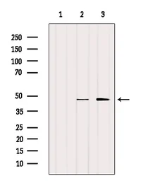 Anti-xCT / SLC7A11 antibody used in Western Blot (WB). GTX04911
