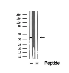 Anti-xCT / SLC7A11 antibody used in Western Blot (WB). GTX04911