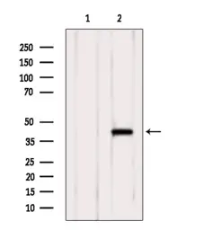 Anti-xCT / SLC7A11 antibody used in Western Blot (WB). GTX04911