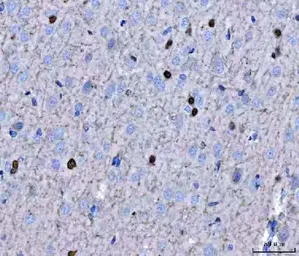Anti-Twist1/2 antibody used in IHC (Paraffin sections) (IHC-P). GTX04942