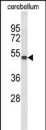 Anti-GAL3ST1 antibody used in Western Blot (WB). GTX04952